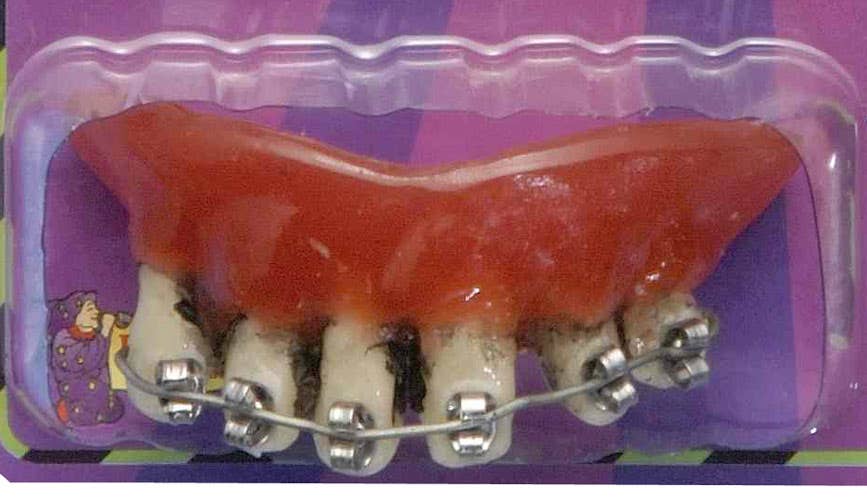 Fake Rotten Hillbilly Costume Teeth with Silver Braces - Alternative View